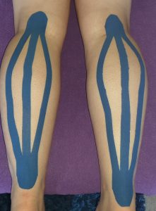 Kinesiology sports Taping for injury recovery.  Stay on the pitch all summer long. 
